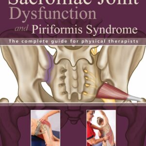 Sacroiliac Joint Dysfunction and Piriformis Syndrome