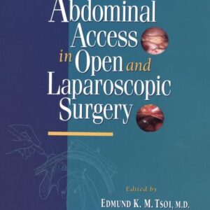 Abdominal Access in Open and Laparoscopic Surgery