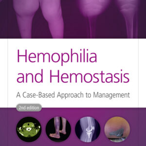 Hemophilia and Hemostasis