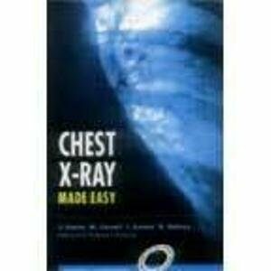 Ise Chest X Ray Made Easy