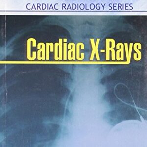 Cardiac X Rays