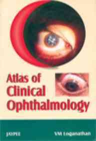 Atlas Of Clinical Ophthalmology