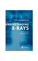 Understanding X Rays