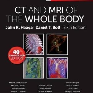 CT AND MRI OF THE WHOLE BODY VOL 1 AND 2