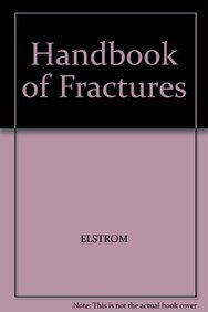 Hand Book Of Fractures