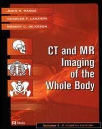 Ct And Mr Imaging Of The Whole Body Set 2 Vol