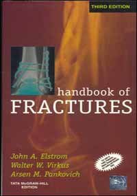 Handbook Of Fractures